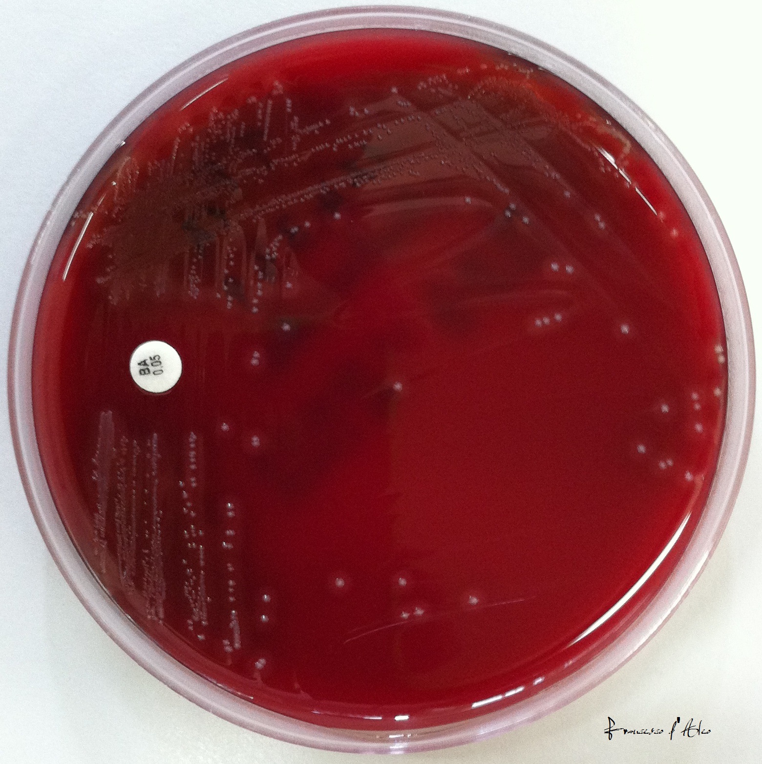 Streptococcus pyogenes Bacitracin test